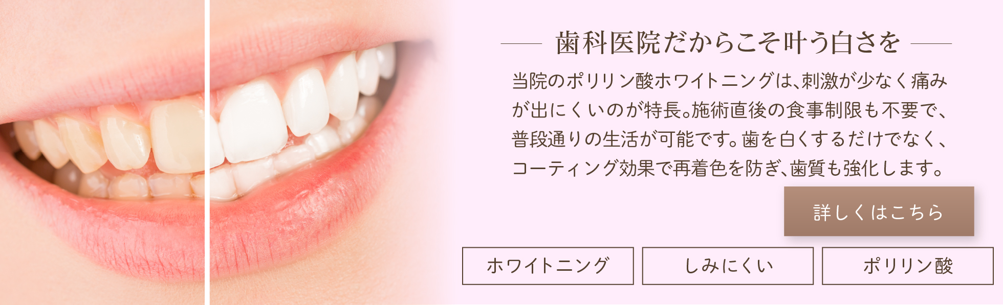 歯科医院だからこそ叶う白さを